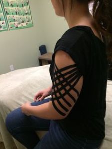 How Kinesiology Tape Works